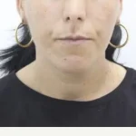 Bărbat din Botoșani anunță dispariția femeii sale; poliția face căutări