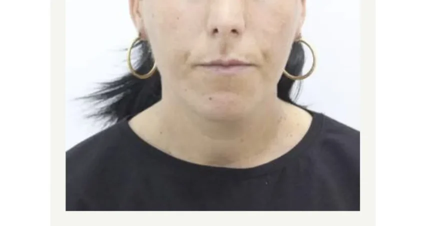 Bărbat din Botoșani anunță dispariția femeii sale; poliția face căutări