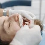 Implant dentar pentru dinți lipsă: câte un implant pentru fiecare dinte?